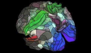 The Map of the Human Brain Is Finally Getting More Useful