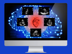 AI Cardiologist Aces Its First Medical Exam